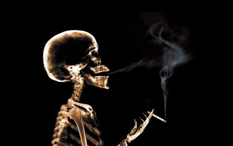 მოწევა, როგორც ზურგის ტკივილის მიზეზი მხრის პირების მიდამოში